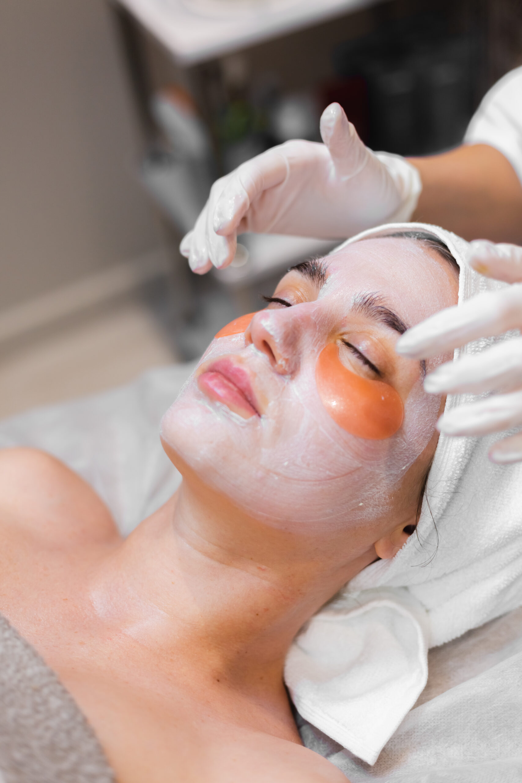 Chemical Peel